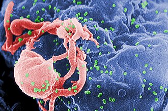 First HIV Discovery Published in Science by French Scientists, May 20, 1983