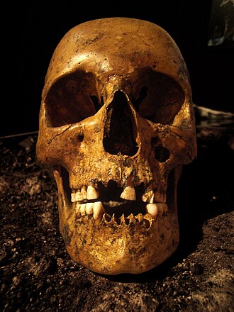Luttra Woman Bog Body Discovered in Sweden, May 20, 1943